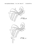 FALLOPIAN TUBE OCCLUSION DEVICE diagram and image