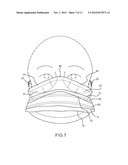 SURGICAL MASK diagram and image