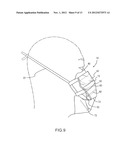 SURGICAL MASK diagram and image