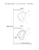 PATTERNED BRUSH HEAD MANUFACTURING PROCESS diagram and image