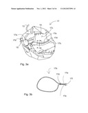 TREATING LICE WITH GASEOUS COMPOUNDS IN AN AIRTIGHT SPACE diagram and image