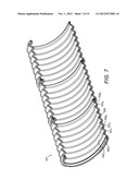 FLEXIBLE PIPE HAVING A CARCASS LAYER diagram and image