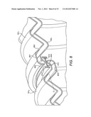 FLEXIBLE PIPE HAVING A CARCASS LAYER diagram and image