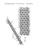 HYBRID STENT AND METHOD OF MAKING diagram and image