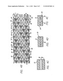 HYBRID STENT AND METHOD OF MAKING diagram and image