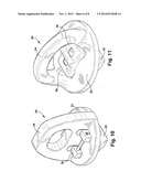 REMOVABLE SAFETY CHAIN TIE DOWN APPARATUS diagram and image