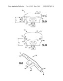 DYNAMIC AIRBAG VENTING diagram and image