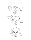 DYNAMIC AIRBAG VENTING diagram and image