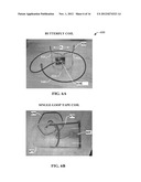 MSC-SELMQC METHOD FOR SIMULTANEOUS MAPPING OF POLYUNSATURATED FATTY ACIDS,     LACTATE AND CHOLINE IN HIGH FAT TISSUES diagram and image