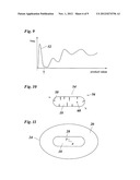 METHOD OF CAPTURING IMAGE DATA FOR IRIS CODE BASED IDENTIFICATION OF     VERTEBRATES diagram and image