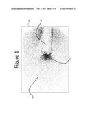 SIGNAL IMAGE EXTRACTION diagram and image