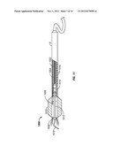 ENERGY HARVESTING INSERT FOR AN ULTRASONIC HANDPIECE WITH ELECTRICAL     DEVICE diagram and image