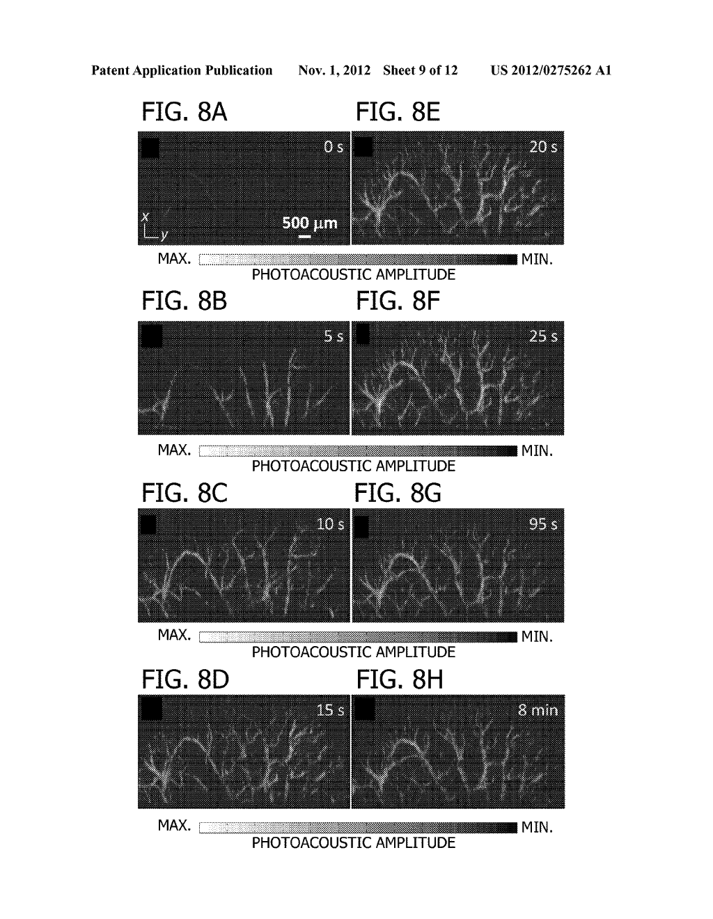 SECTION-ILLUMINATION PHOTOACOUSTIC MICROSCOPY WITH ULTRASONIC ARRAY     DETECTION - diagram, schematic, and image 10