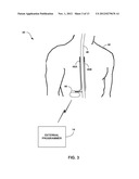 IMAGE-BASED ANALYSIS OF IMPLANTABLE MEDICAL DEVICE POSITIONING diagram and image