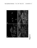 METHODS AND COMPOSITIONS FOR TREATING CONDITIONS ASSOCIATED WITH     ANGIOGENESIS USING A VASCULAR ADHESION PROTEIN-1 (VAP-1) INHIBITOR diagram and image