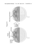 METHODS AND COMPOSITIONS FOR TREATING CONDITIONS ASSOCIATED WITH     ANGIOGENESIS USING A VASCULAR ADHESION PROTEIN-1 (VAP-1) INHIBITOR diagram and image