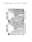 METHODS AND COMPOSITIONS FOR TREATING CONDITIONS ASSOCIATED WITH     ANGIOGENESIS USING A VASCULAR ADHESION PROTEIN-1 (VAP-1) INHIBITOR diagram and image