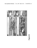 METHODS AND COMPOSITIONS FOR TREATING CONDITIONS ASSOCIATED WITH     ANGIOGENESIS USING A VASCULAR ADHESION PROTEIN-1 (VAP-1) INHIBITOR diagram and image