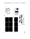 METHODS FOR DIAGNOSIS AND TREATMENT OF CELLULAR PROLIFERATIVE DISORDERS diagram and image