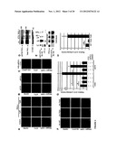 METHODS FOR DIAGNOSIS AND TREATMENT OF CELLULAR PROLIFERATIVE DISORDERS diagram and image