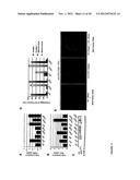 METHODS FOR DIAGNOSIS AND TREATMENT OF CELLULAR PROLIFERATIVE DISORDERS diagram and image