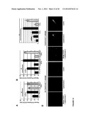 METHODS FOR DIAGNOSIS AND TREATMENT OF CELLULAR PROLIFERATIVE DISORDERS diagram and image