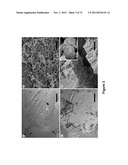 EXTRACELLULAR MATRIX PROTEINS FROM HAEMOPHILUS INFLUENZAE BIOFILMS:     TARGETS FOR THERAPEUTIC OR DIAGNOSTIC USE diagram and image