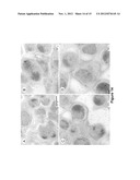 EXTRACELLULAR MATRIX PROTEINS FROM HAEMOPHILUS INFLUENZAE BIOFILMS:     TARGETS FOR THERAPEUTIC OR DIAGNOSTIC USE diagram and image