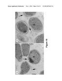 EXTRACELLULAR MATRIX PROTEINS FROM HAEMOPHILUS INFLUENZAE BIOFILMS:     TARGETS FOR THERAPEUTIC OR DIAGNOSTIC USE diagram and image