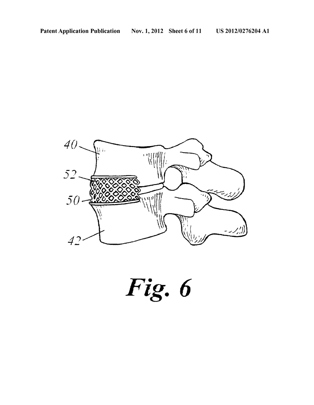 Bone Growth Compositions and Methods - diagram, schematic, and image 07