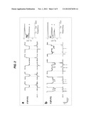 LABEL-FREE SENSING OF PNA-DNA COMPLEXES USING NANOPORES diagram and image