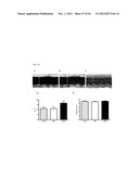 NOVEL COMPOUNDS FOR MODULATING NEOVASCULARISATION AND METHODS OF TREATMENT     USING THESE COMPOUNDS diagram and image