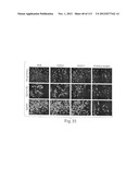 POLYPEPTIDE COMPOUNDS FOR INHIBITING ANGIOGENESIS AND TUMOR GROWTH diagram and image