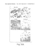 POLYPEPTIDE COMPOUNDS FOR INHIBITING ANGIOGENESIS AND TUMOR GROWTH diagram and image