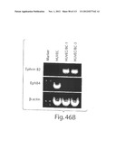 POLYPEPTIDE COMPOUNDS FOR INHIBITING ANGIOGENESIS AND TUMOR GROWTH diagram and image