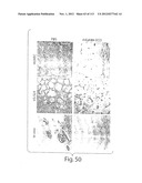 POLYPEPTIDE COMPOUNDS FOR INHIBITING ANGIOGENESIS AND TUMOR GROWTH diagram and image