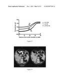 Method of Increasing Intratumoral pHe and Reducing Acid-Mediated Invasion diagram and image