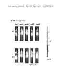 Method of Increasing Intratumoral pHe and Reducing Acid-Mediated Invasion diagram and image