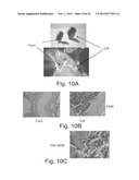 ANTISENSE OLIGONUCLEOTIDES AGAINST cPLA2, COMPOSITIONS AND USES THEREOF diagram and image