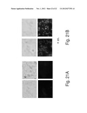 ANTISENSE OLIGONUCLEOTIDES AGAINST cPLA2, COMPOSITIONS AND USES THEREOF diagram and image