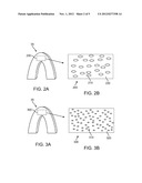 STENT WITH NUCLEATING AGENT diagram and image