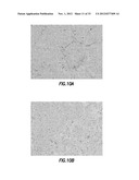 METAL-POLYSACCHARIDE CONJUGATES: COMPOSITIONS, SYNTHESIS AND METHODS FOR     CANCER THERAPY diagram and image