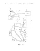 SYSTEMS AND METHODS FOR GUIDING CATHETERS USING REGISTERED IMAGES diagram and image