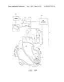 SYSTEMS AND METHODS FOR GUIDING CATHETERS USING REGISTERED IMAGES diagram and image