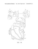 SYSTEMS AND METHODS FOR GUIDING CATHETERS USING REGISTERED IMAGES diagram and image