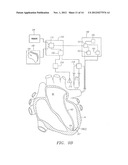 SYSTEMS AND METHODS FOR GUIDING CATHETERS USING REGISTERED IMAGES diagram and image