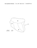 SYSTEMS AND METHODS FOR GUIDING CATHETERS USING REGISTERED IMAGES diagram and image