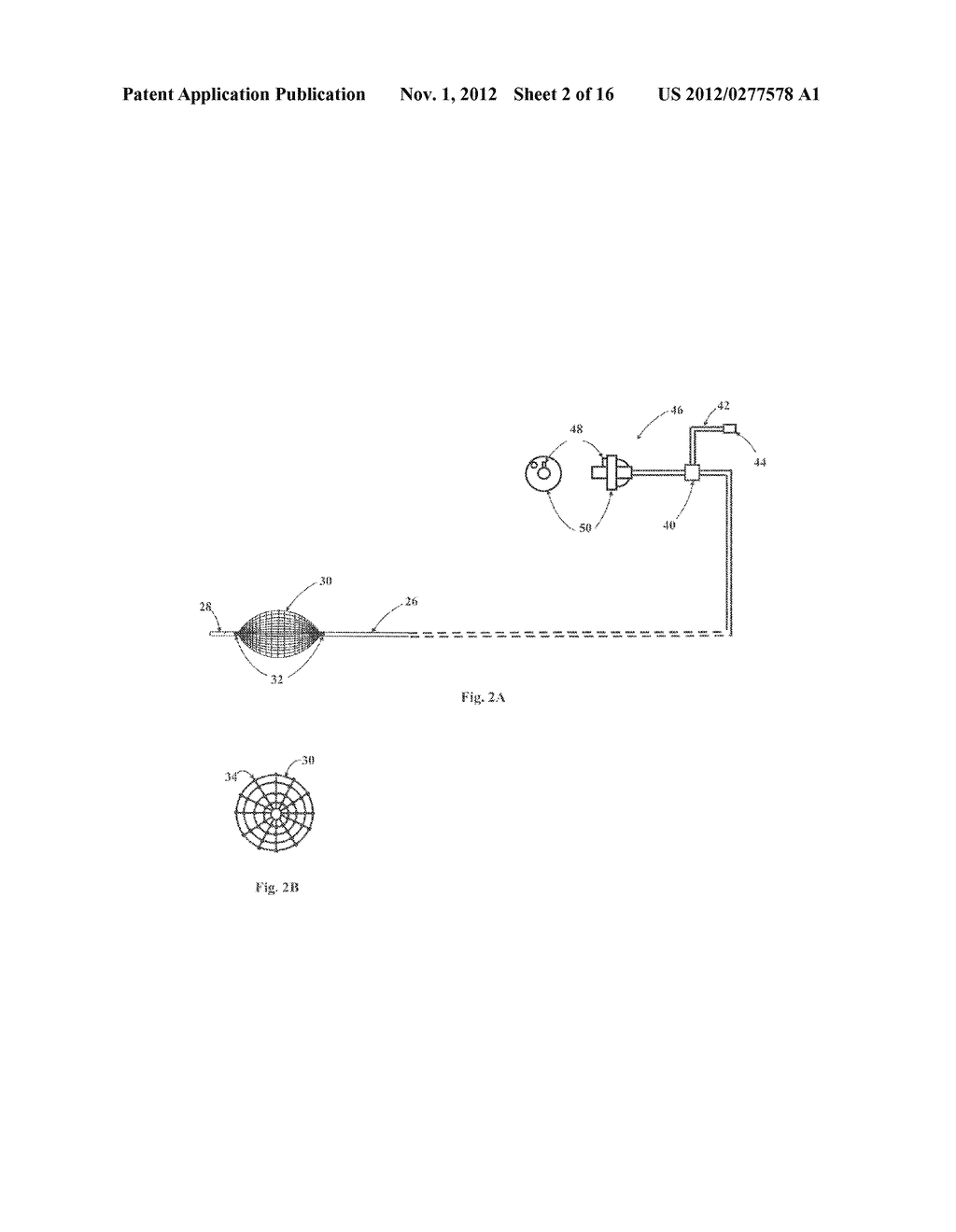 Balloon Resection Method - diagram, schematic, and image 03