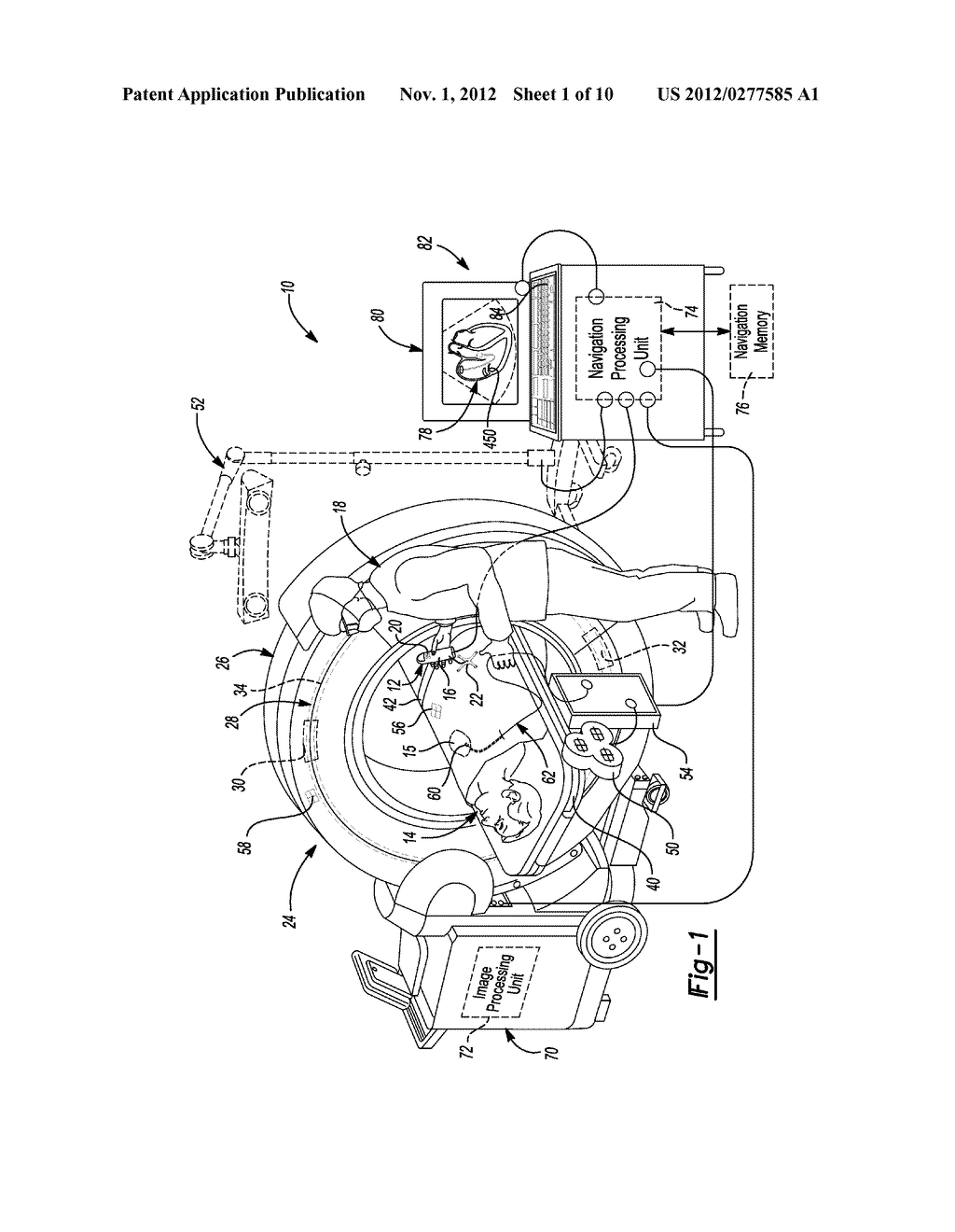 Method and Apparatus for Calibrating and Re-aligning an Ultrasound Image     Plane to a Navigation Tracker - diagram, schematic, and image 02