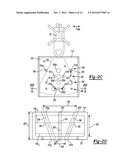 Method and Apparatus for Calibrating and Re-aligning an Ultrasound Image     Plane to a Navigation Tracker diagram and image